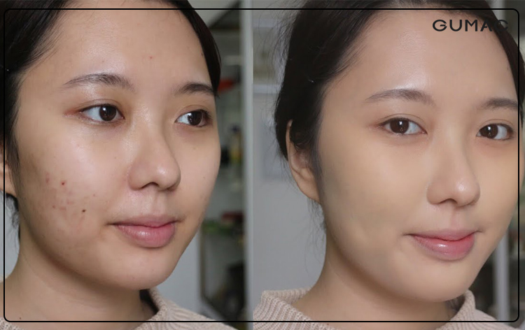 Cách make up che mụn thâm 
